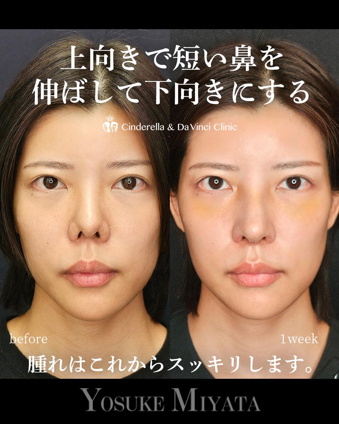 短い鼻を伸ばすの画像