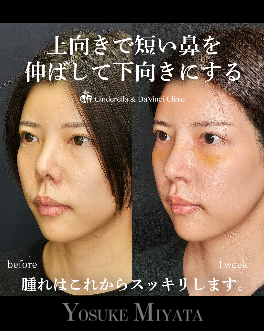 短い鼻を伸ばすの画像