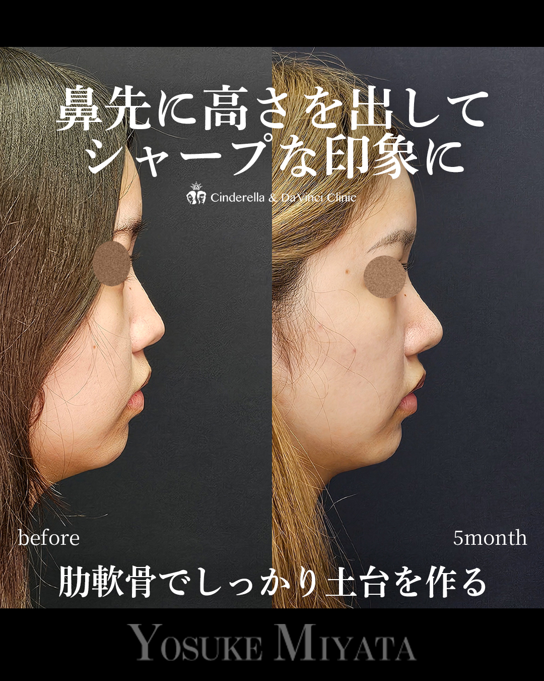 シャープな鼻先にの画像