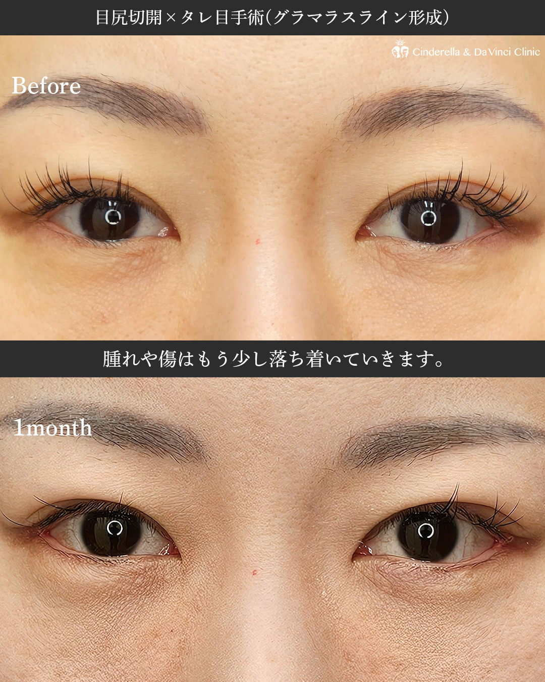 同時施術で変化の画像