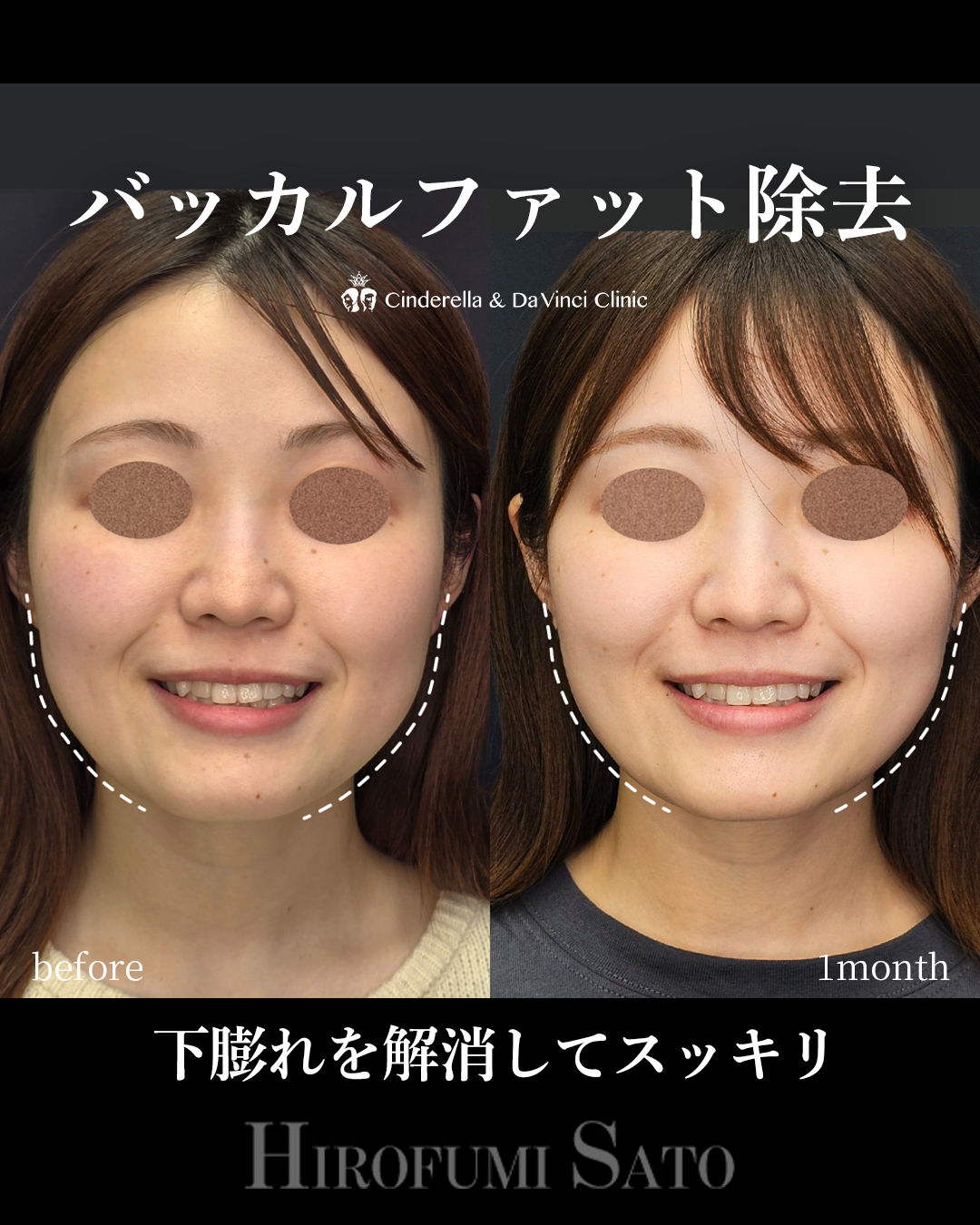 輪郭スッキリの画像