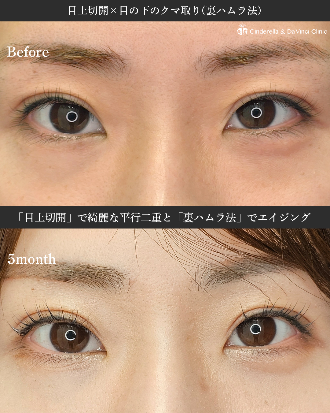 更に美しくなる施術の画像