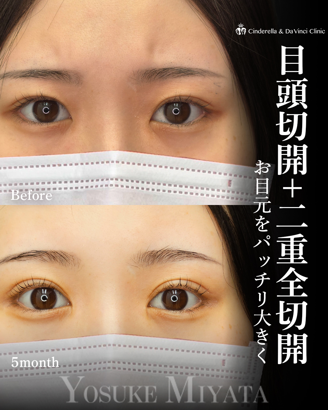 ぱっちり目元の画像