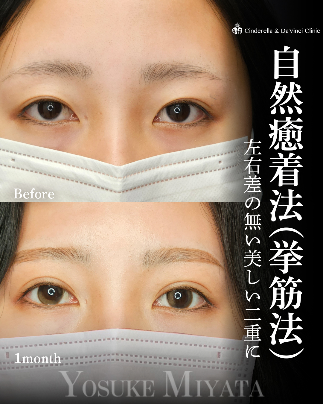 均整の二重美の画像