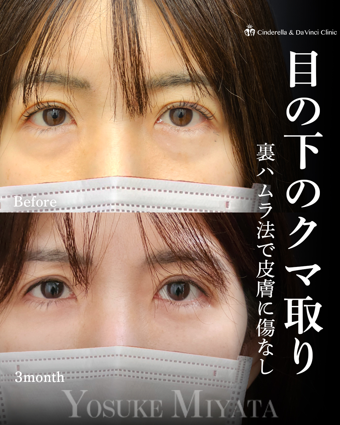 傷がないクマ取りの画像