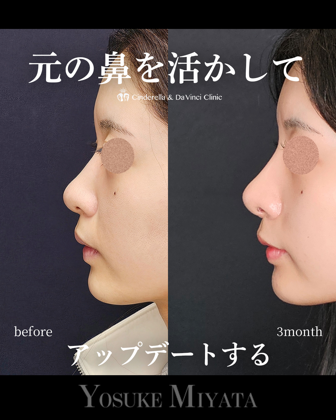 元を活かしてアプデの画像