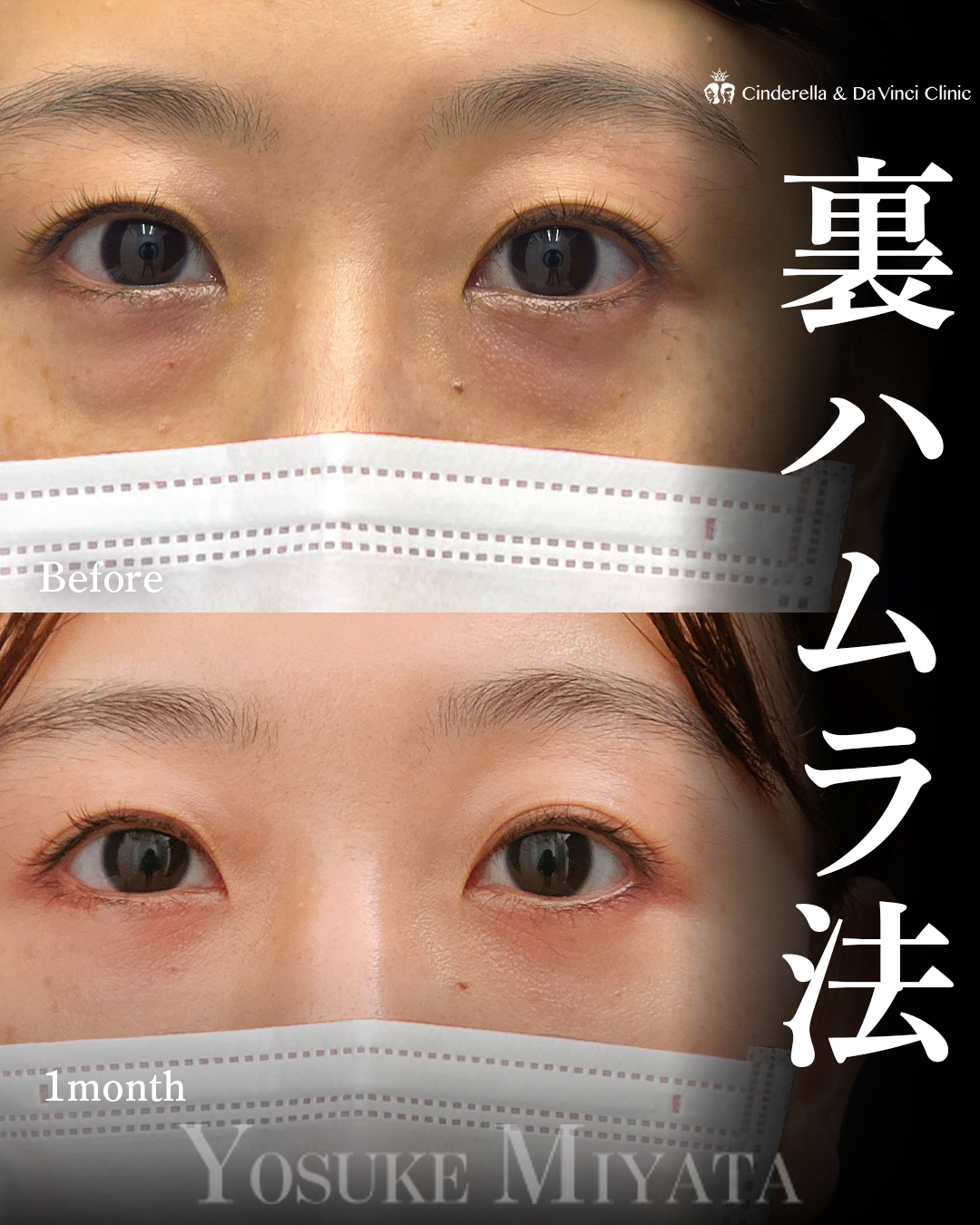 スッピンでも明るくの画像