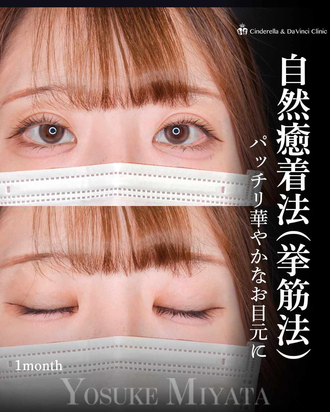 華やかで可愛い二重の画像