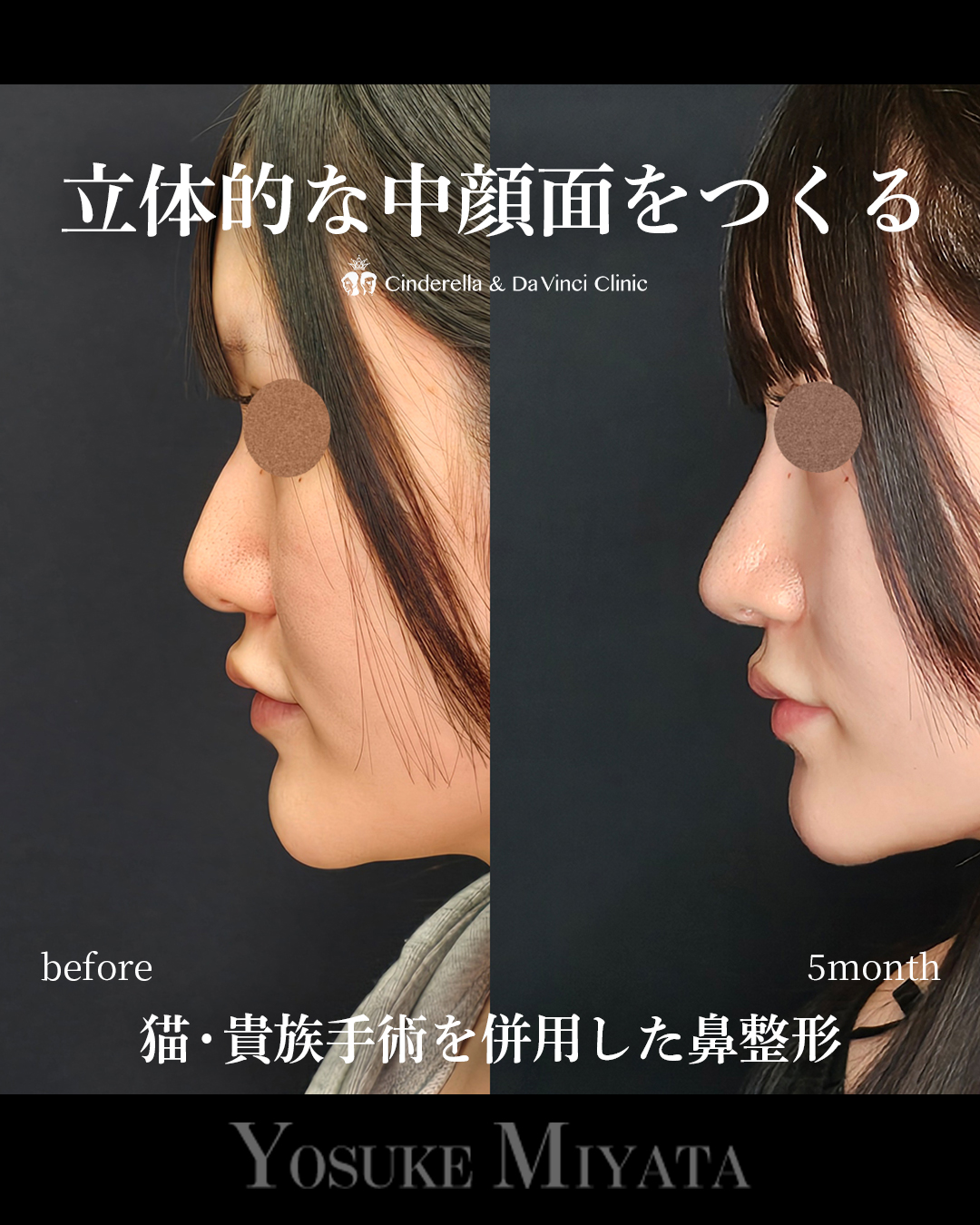 立体的な中顔面の画像