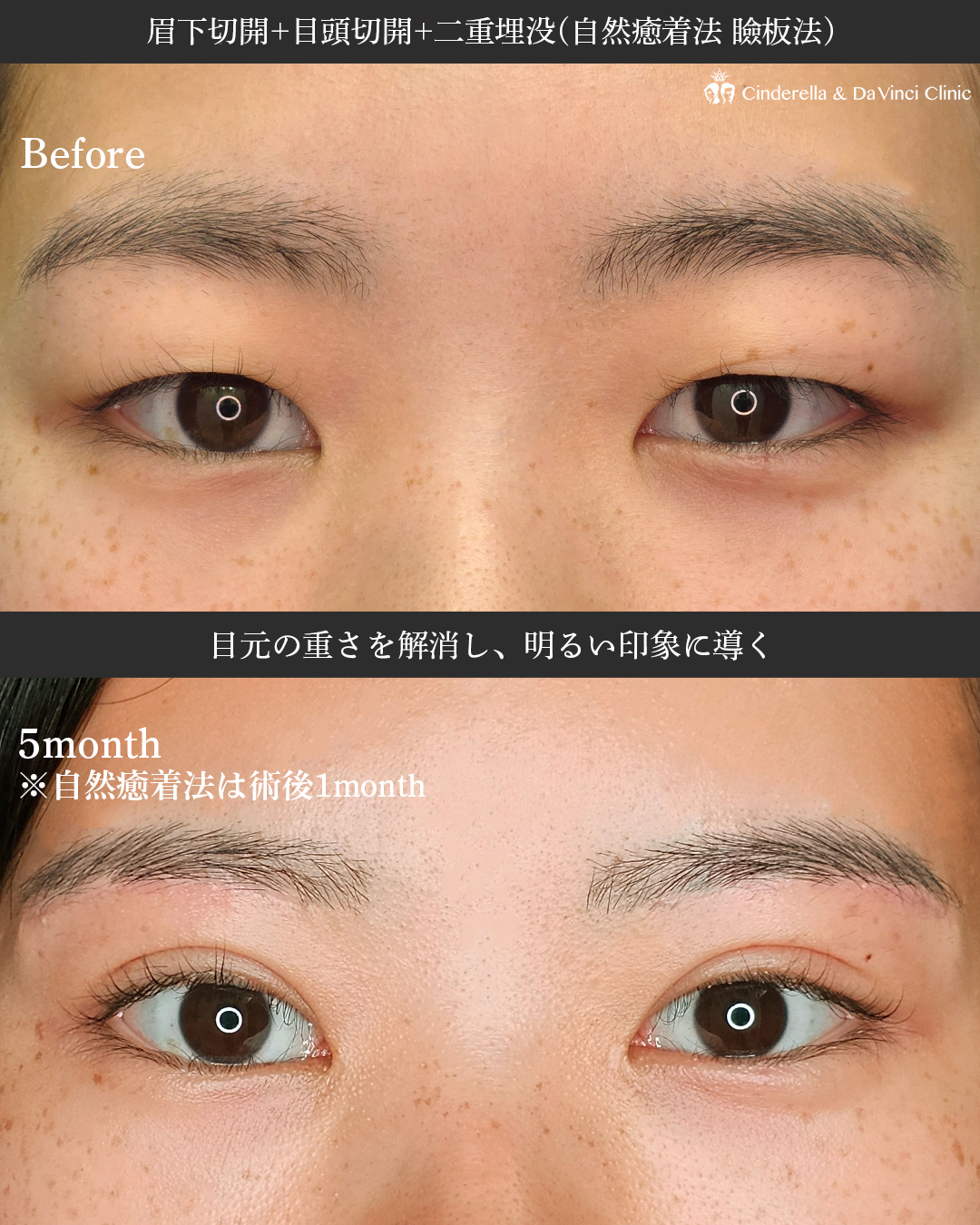 三施術で印象変化の画像