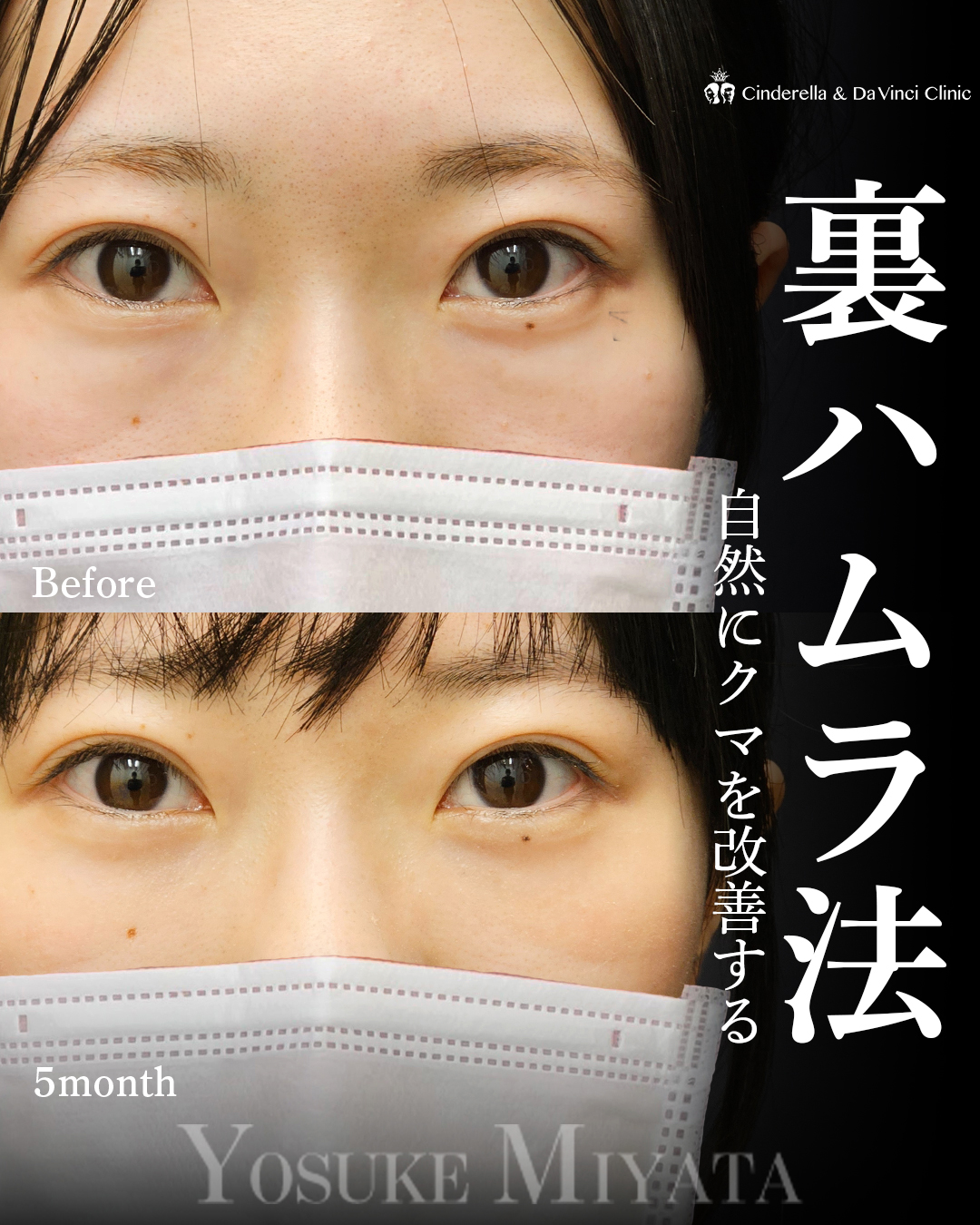 自然にクマ治療の画像
