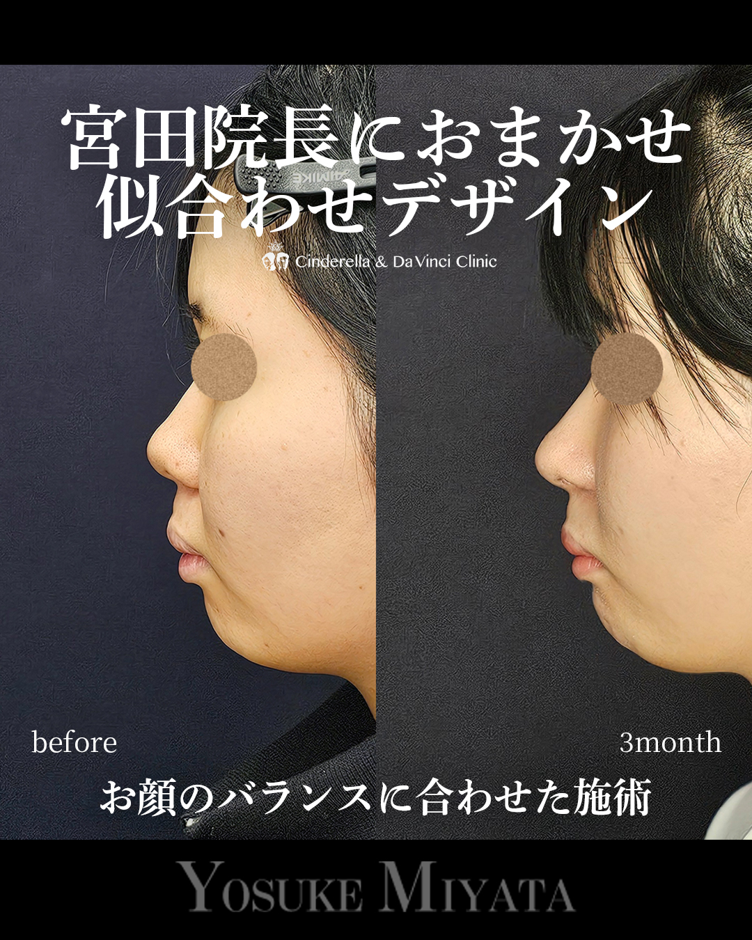 おまかせデザインの画像