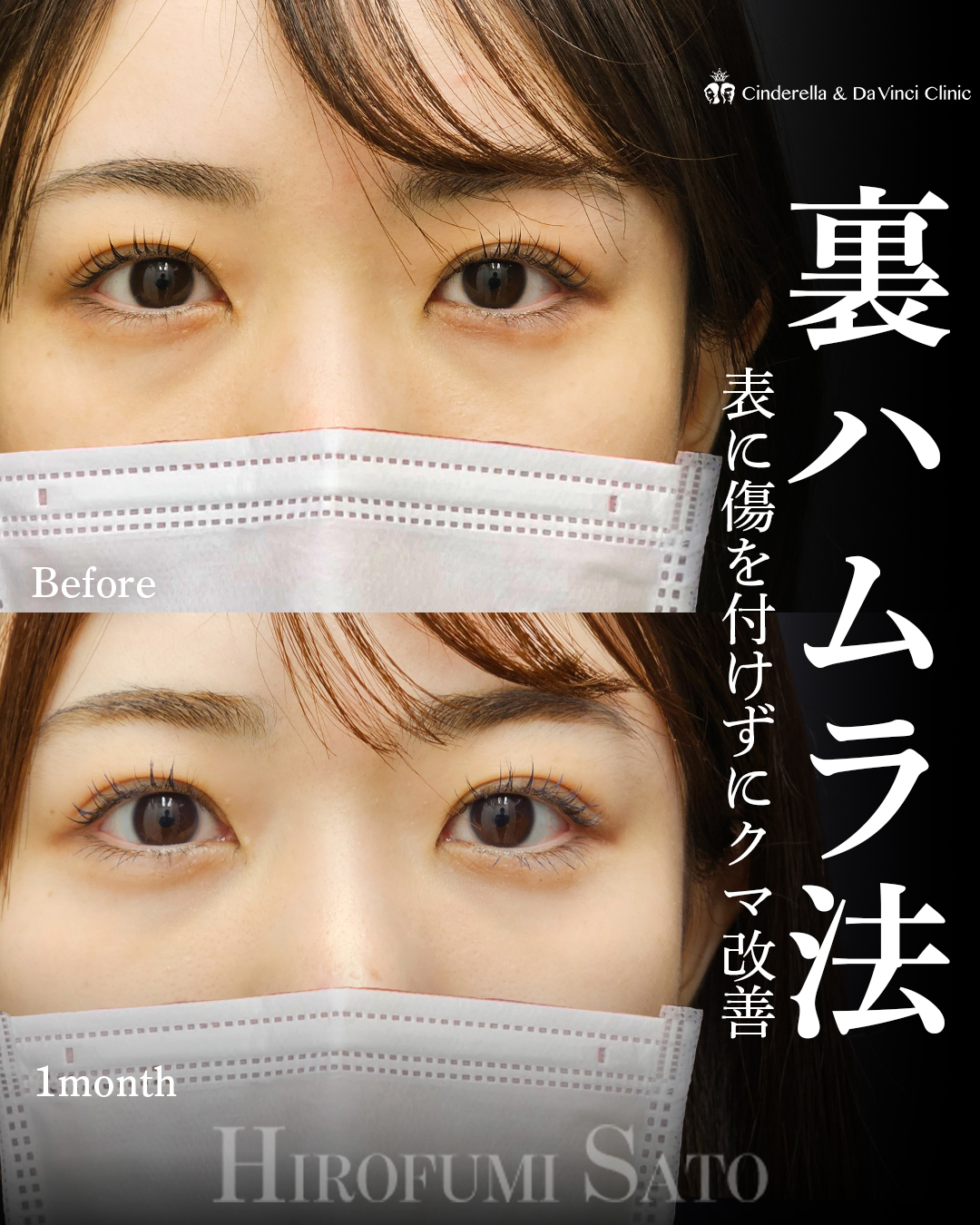 疲れ顔を卒業の画像