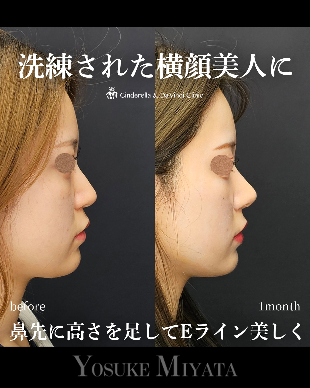 洗練された鼻にの画像