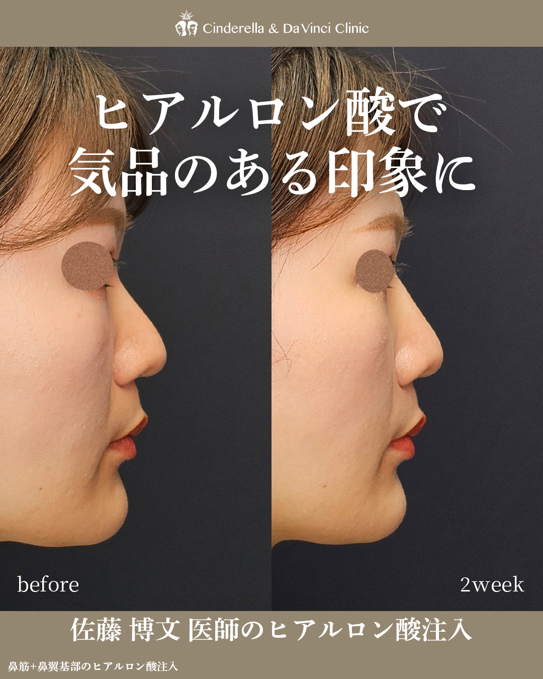 気品のある印象にの画像