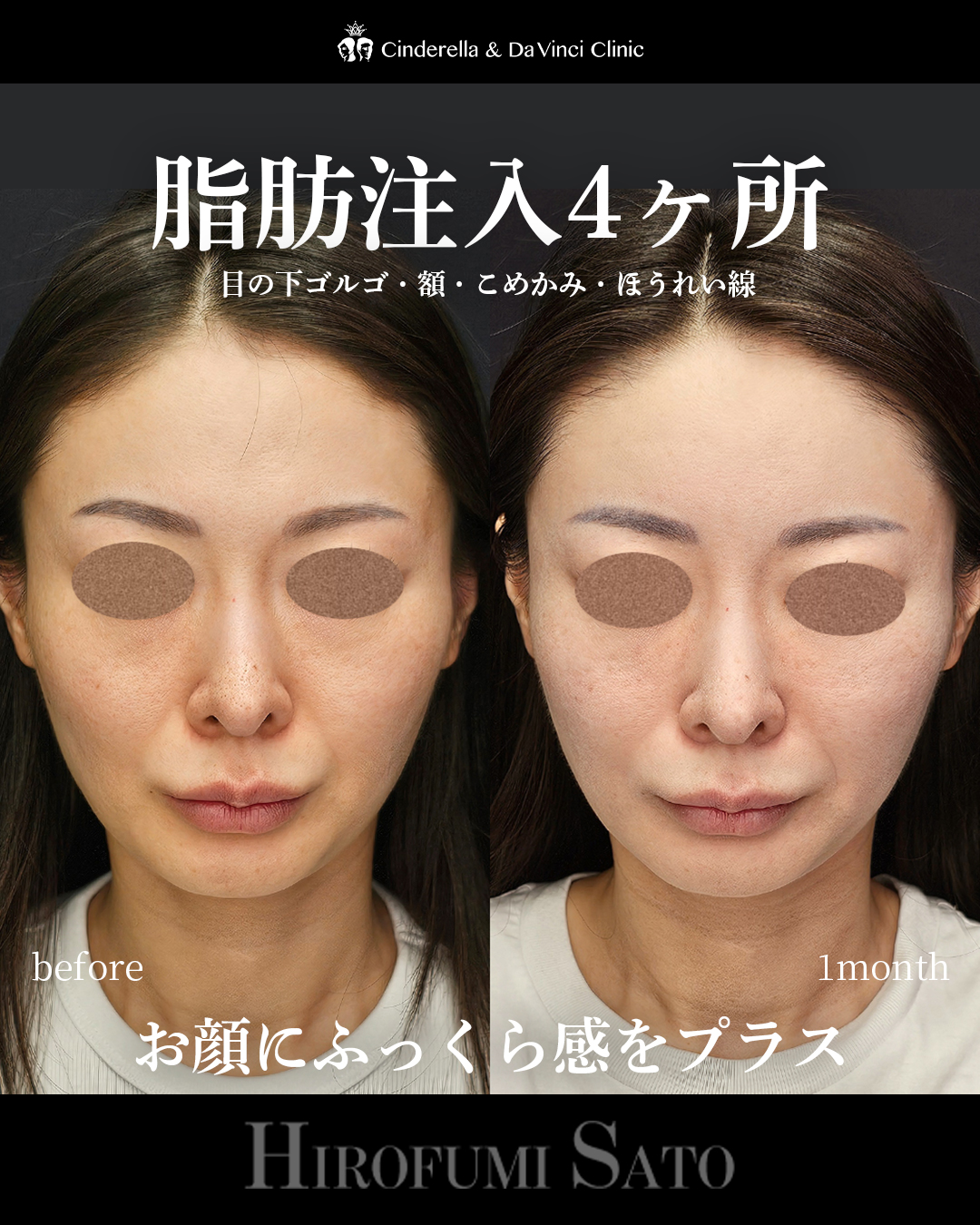 ふっくら感プラスの画像