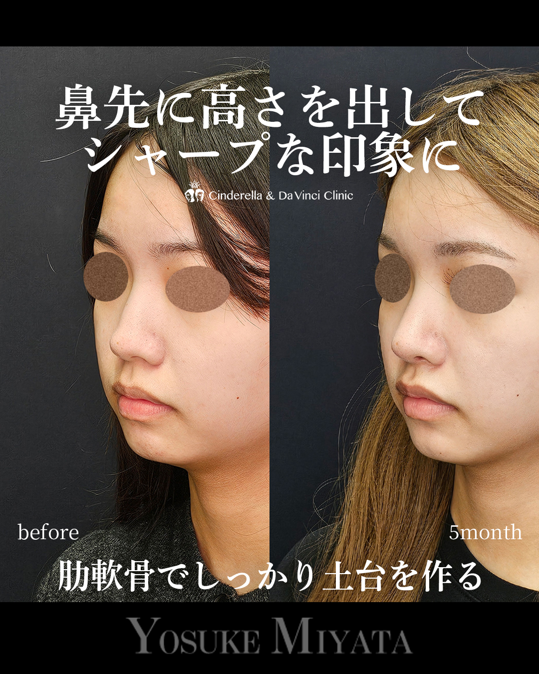 シャープな鼻先にの画像