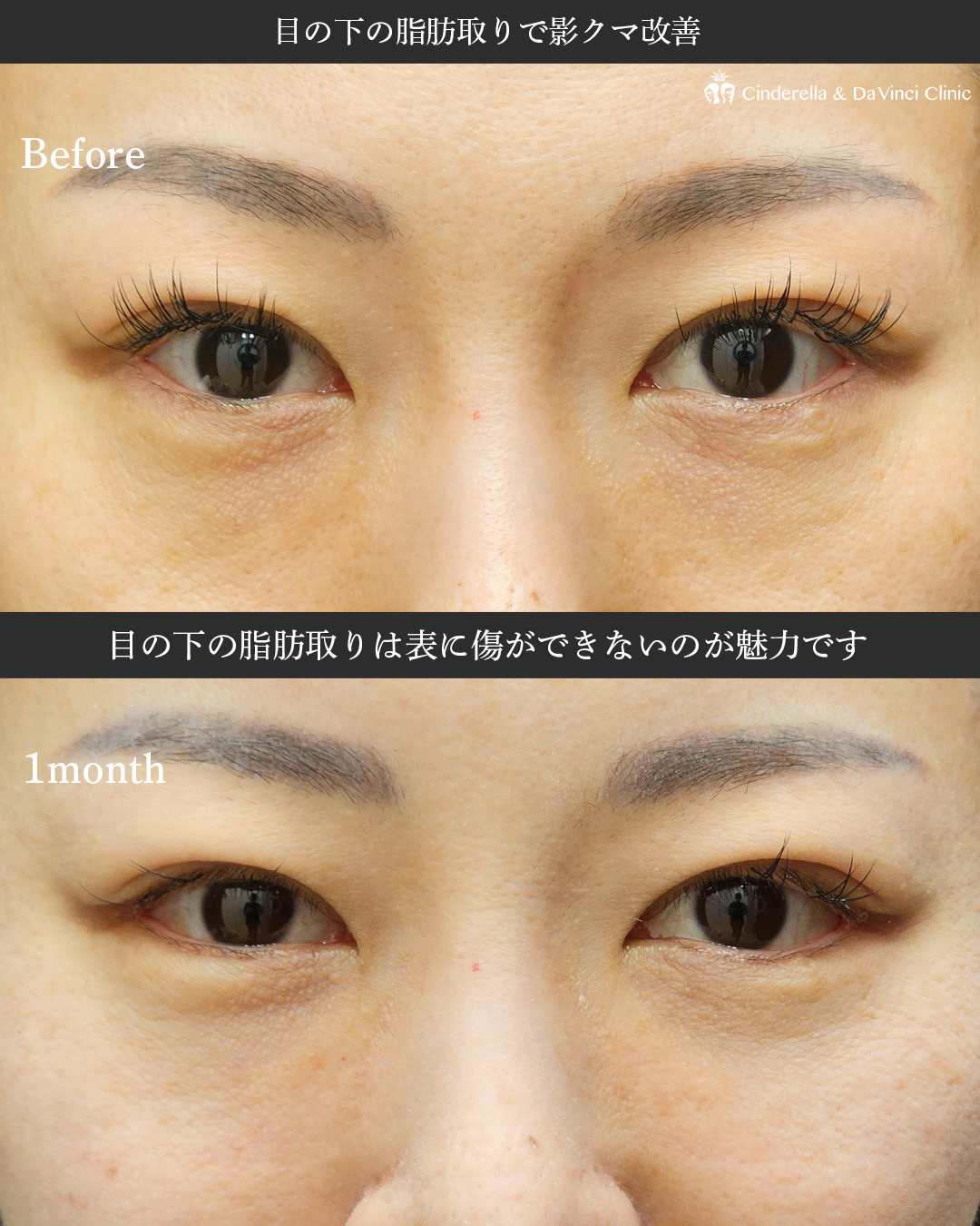 同時施術で変化の画像