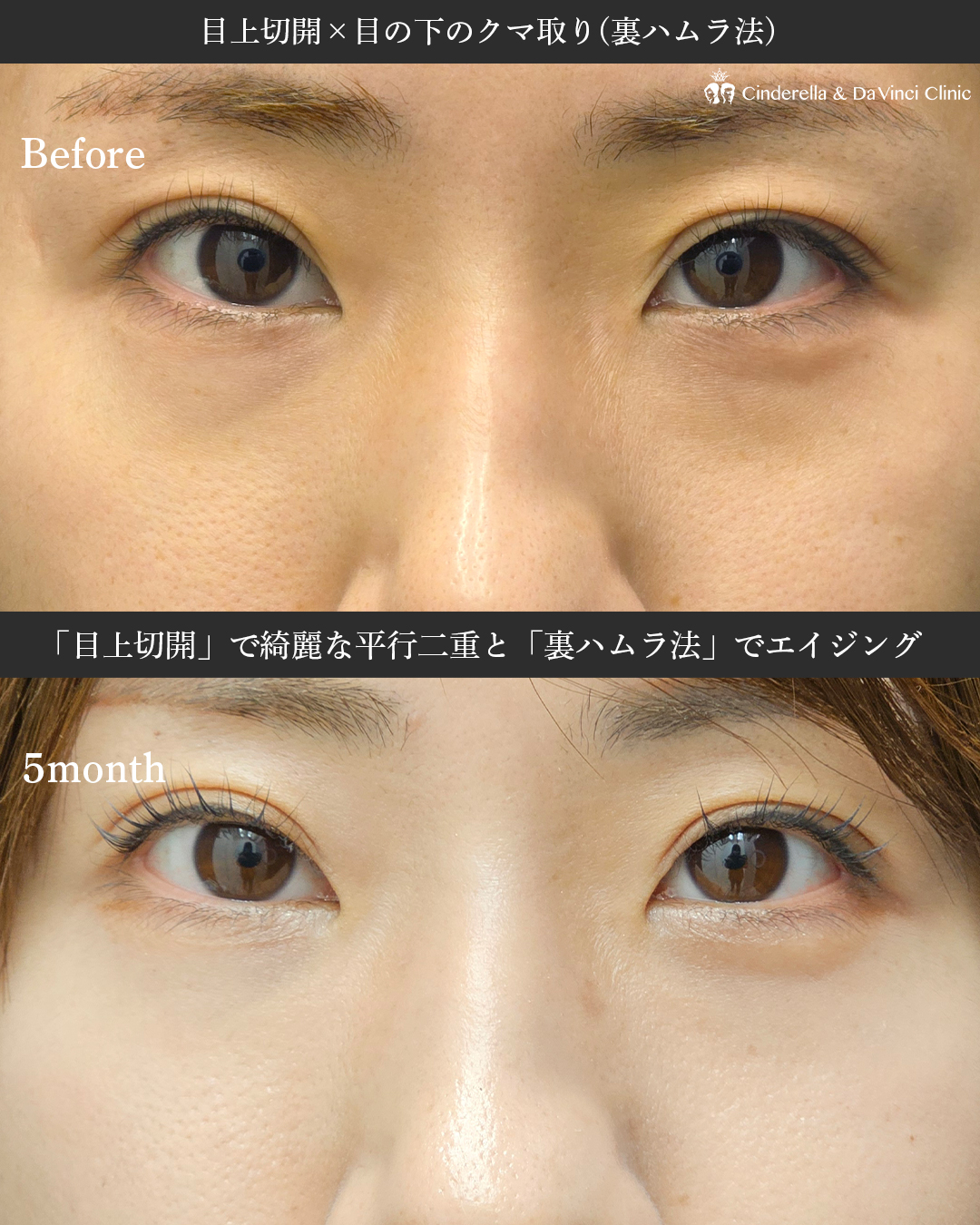 更に美しくなる施術の画像