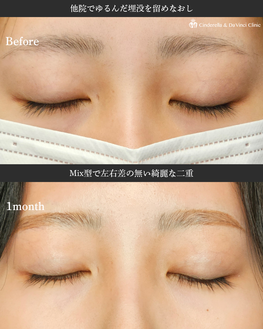 均整の二重美の画像
