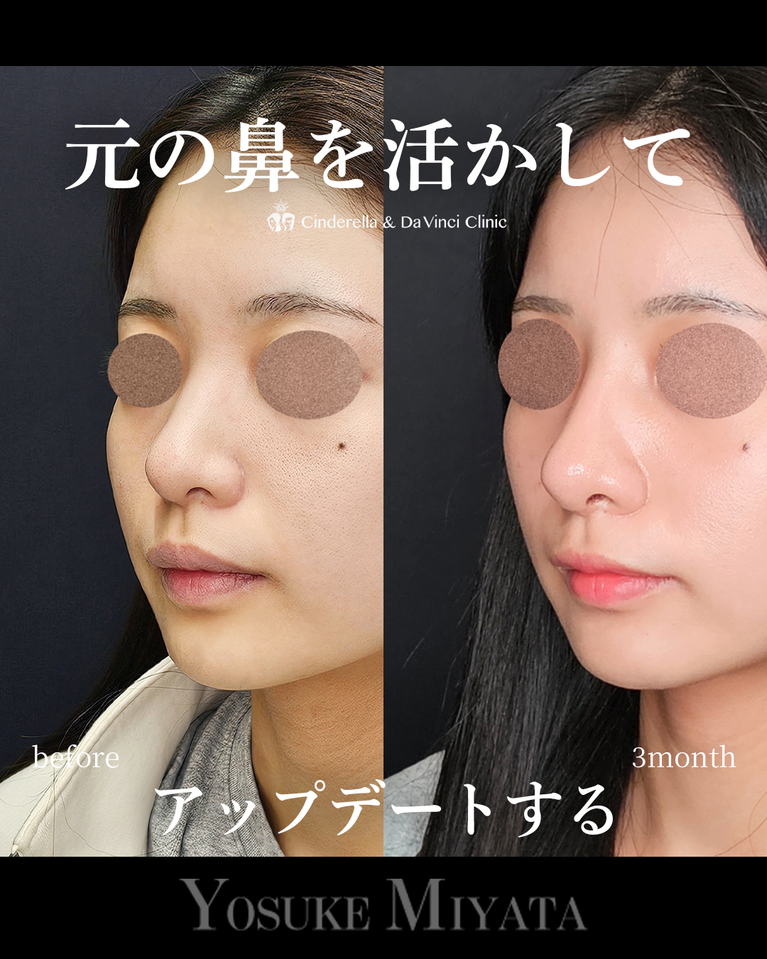 元を活かしてアプデの画像