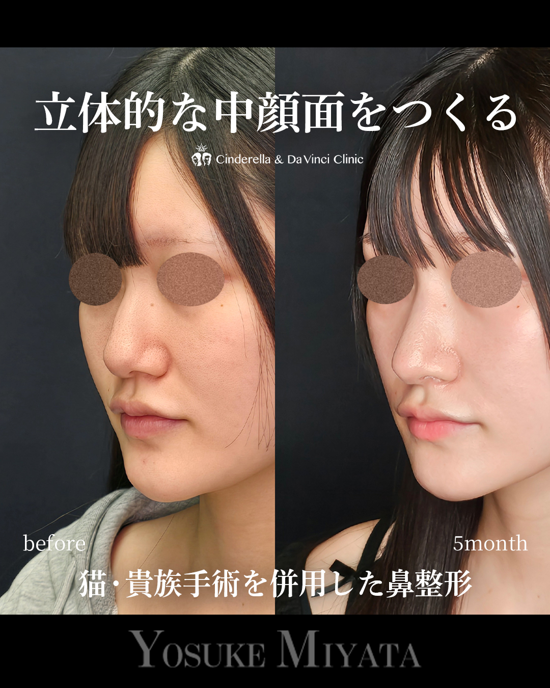 立体的な中顔面の画像