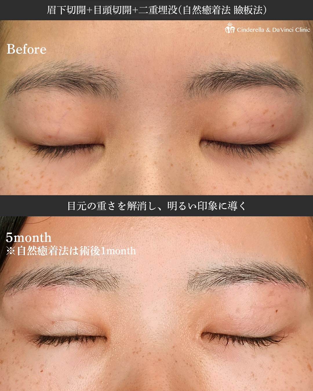 三施術で印象変化の画像