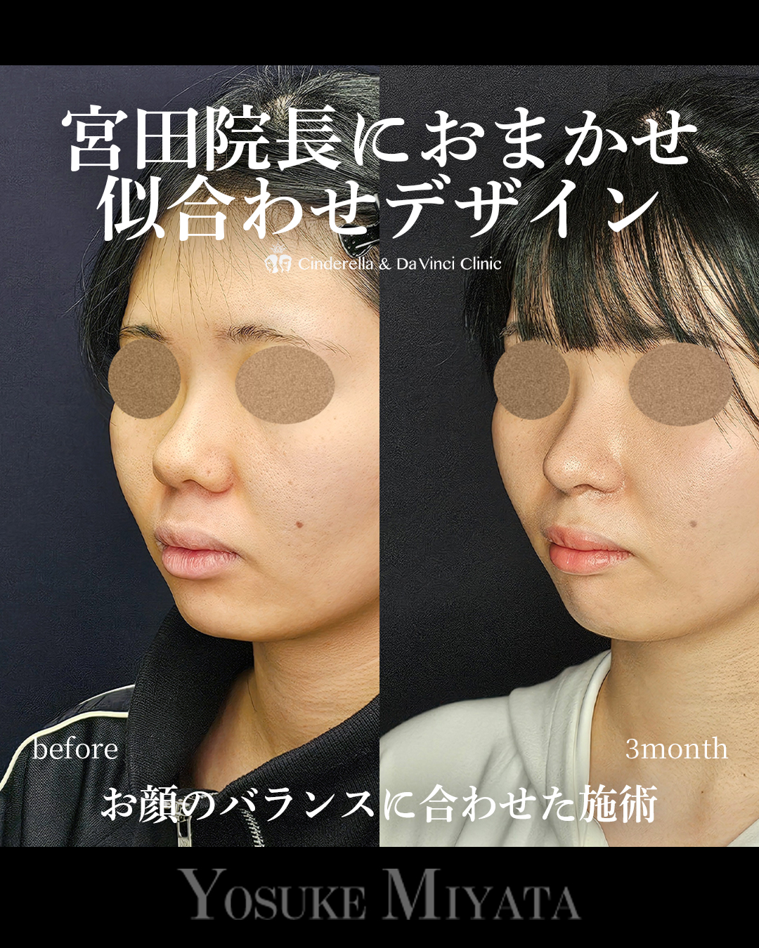おまかせデザインの画像