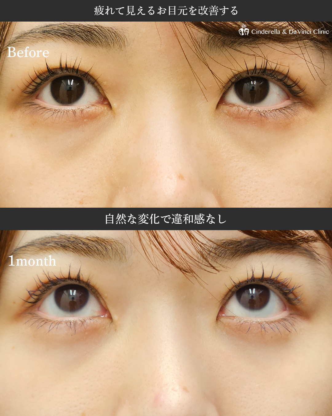 疲れ顔を卒業の画像