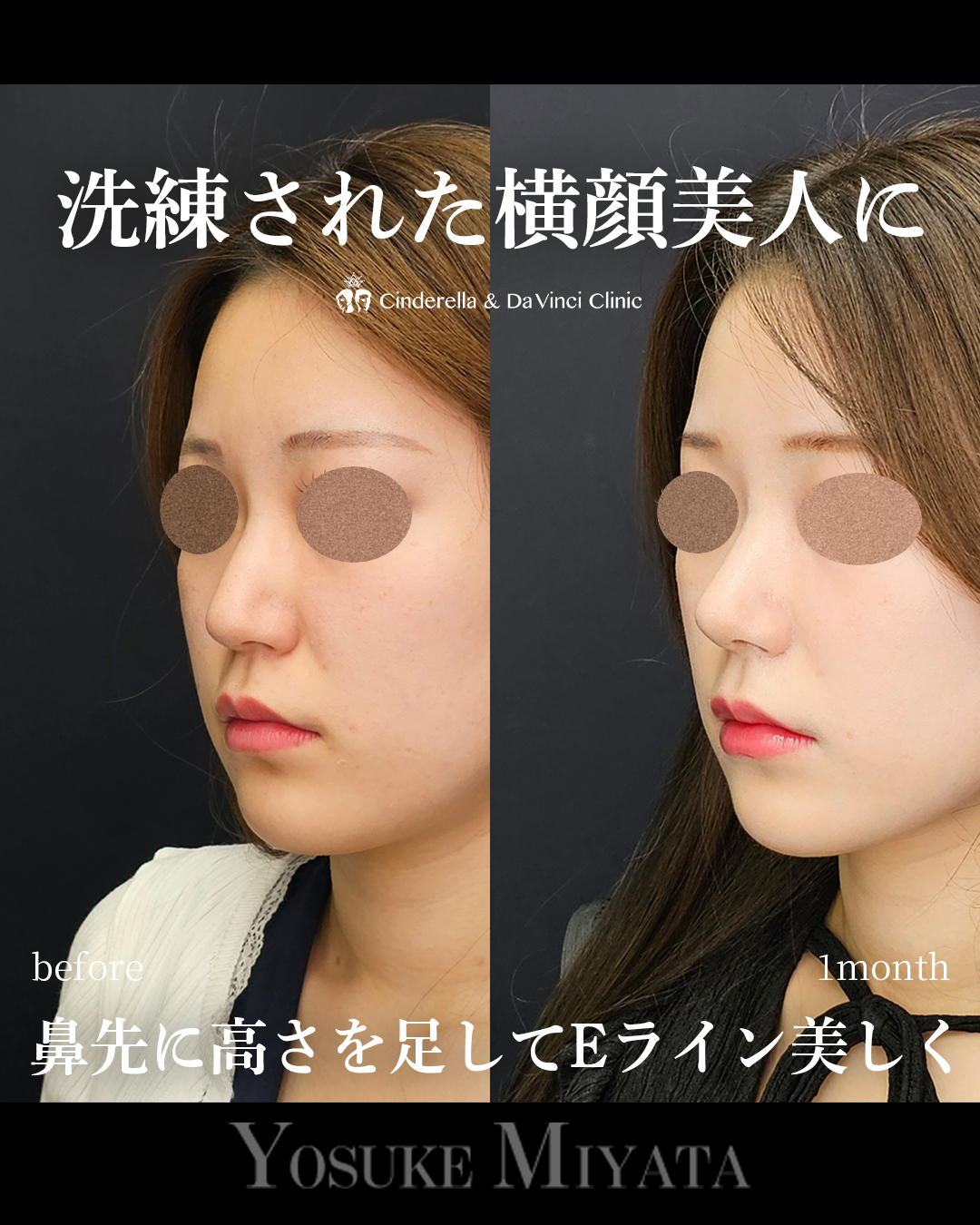 洗練された鼻にの画像