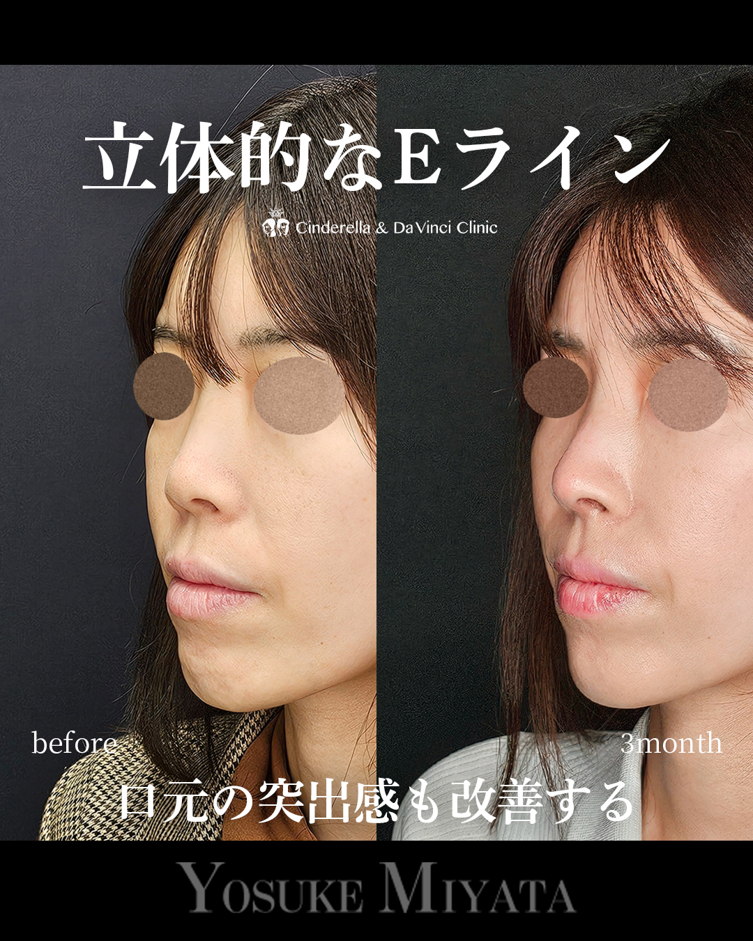 立体的な横顔の画像