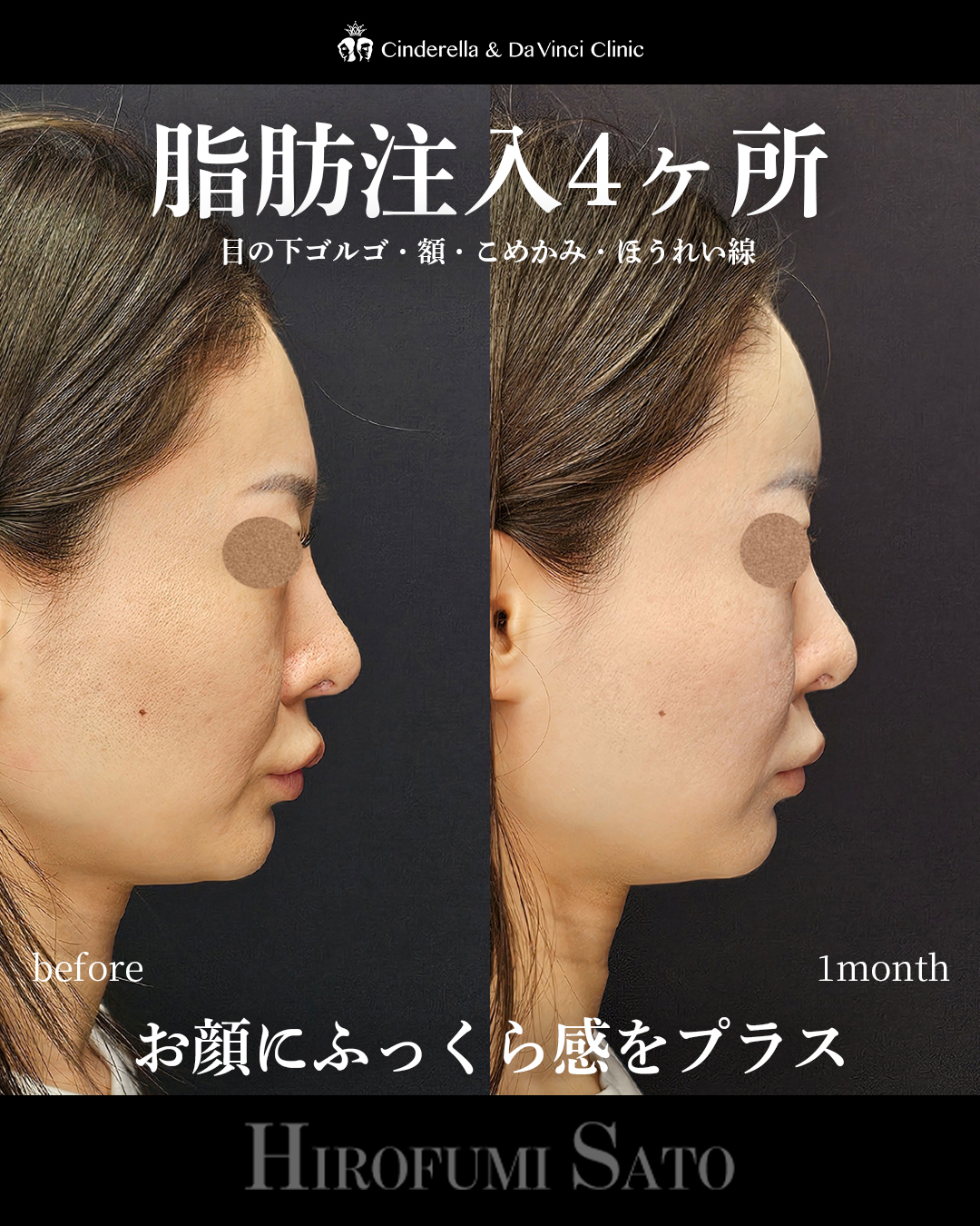 ふっくら感プラスの画像