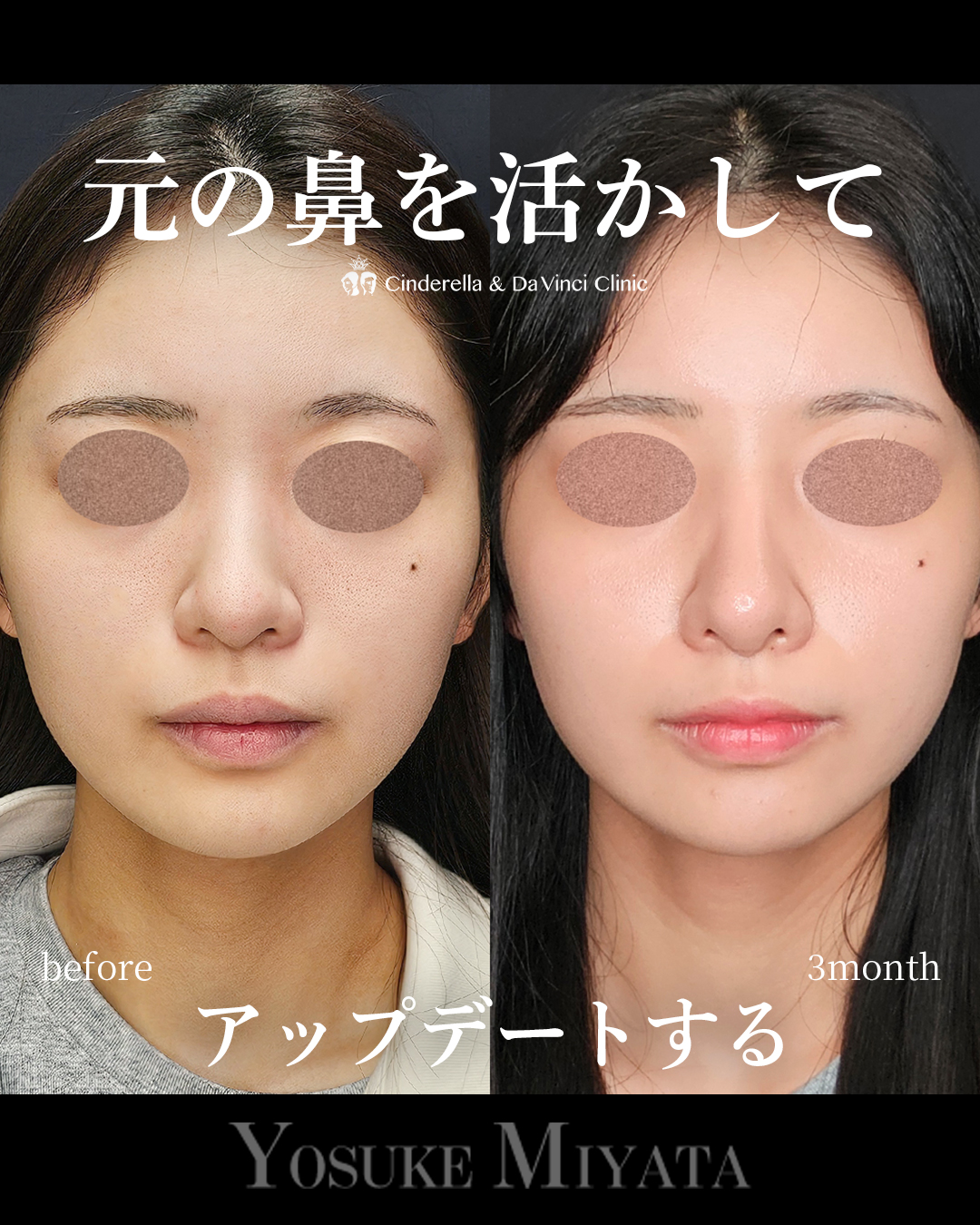 元を活かしてアプデの画像