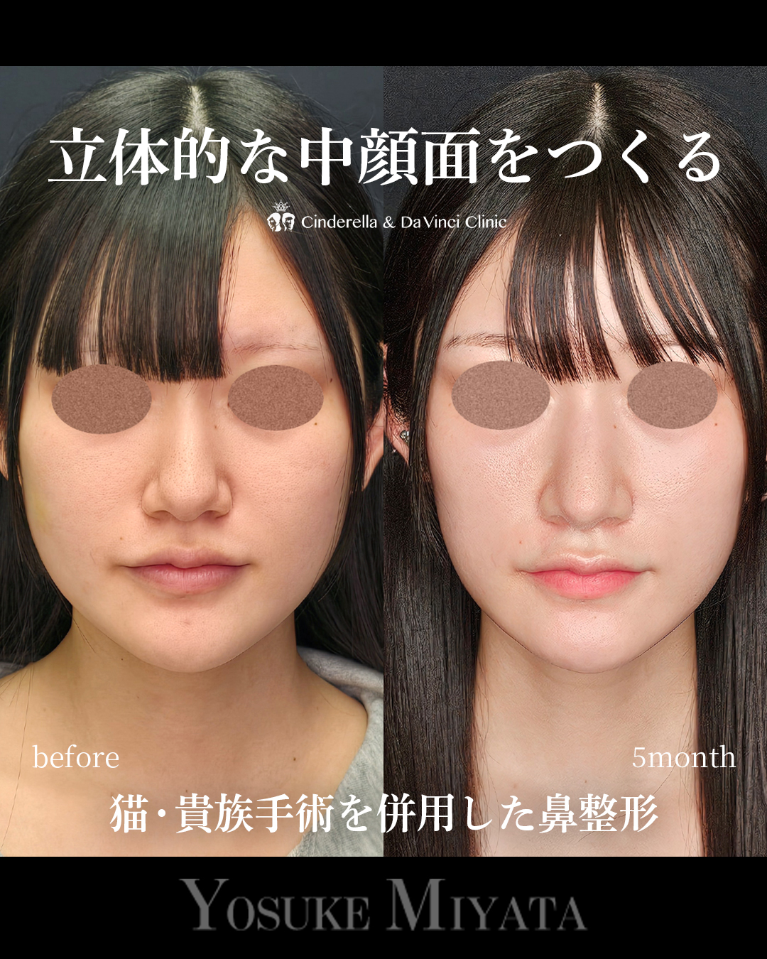 立体的な中顔面の画像