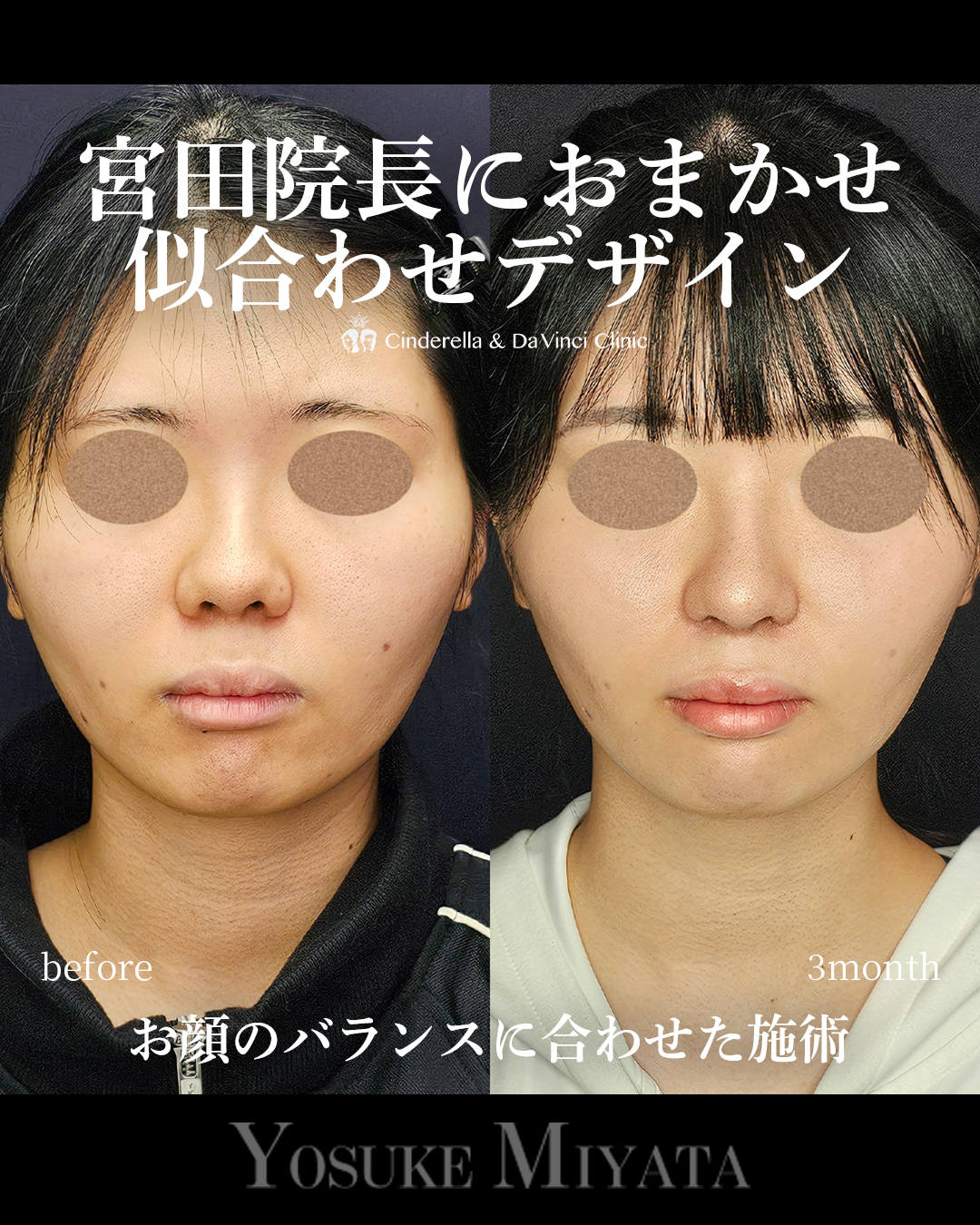 おまかせデザインの画像