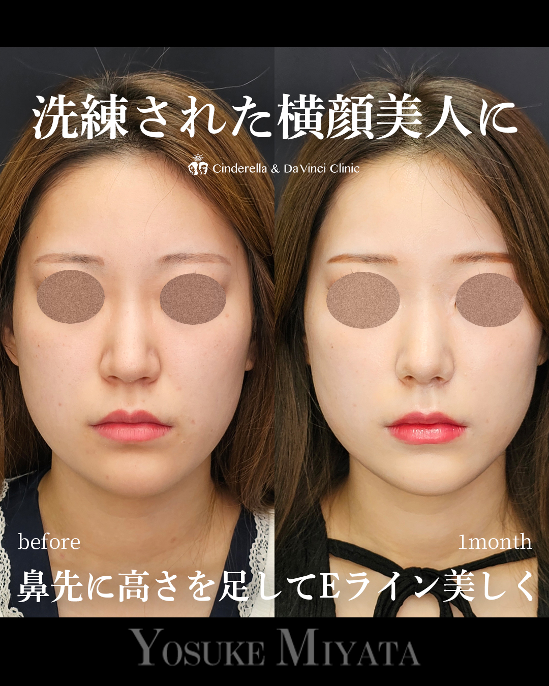 洗練された鼻にの画像