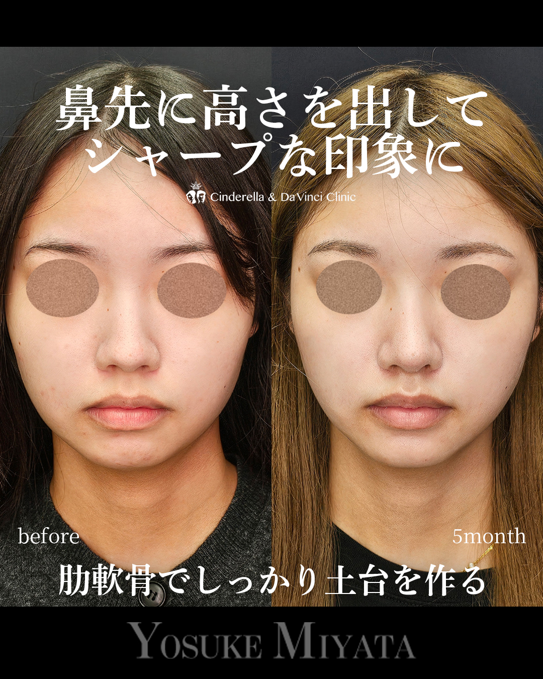 シャープな鼻先にの画像