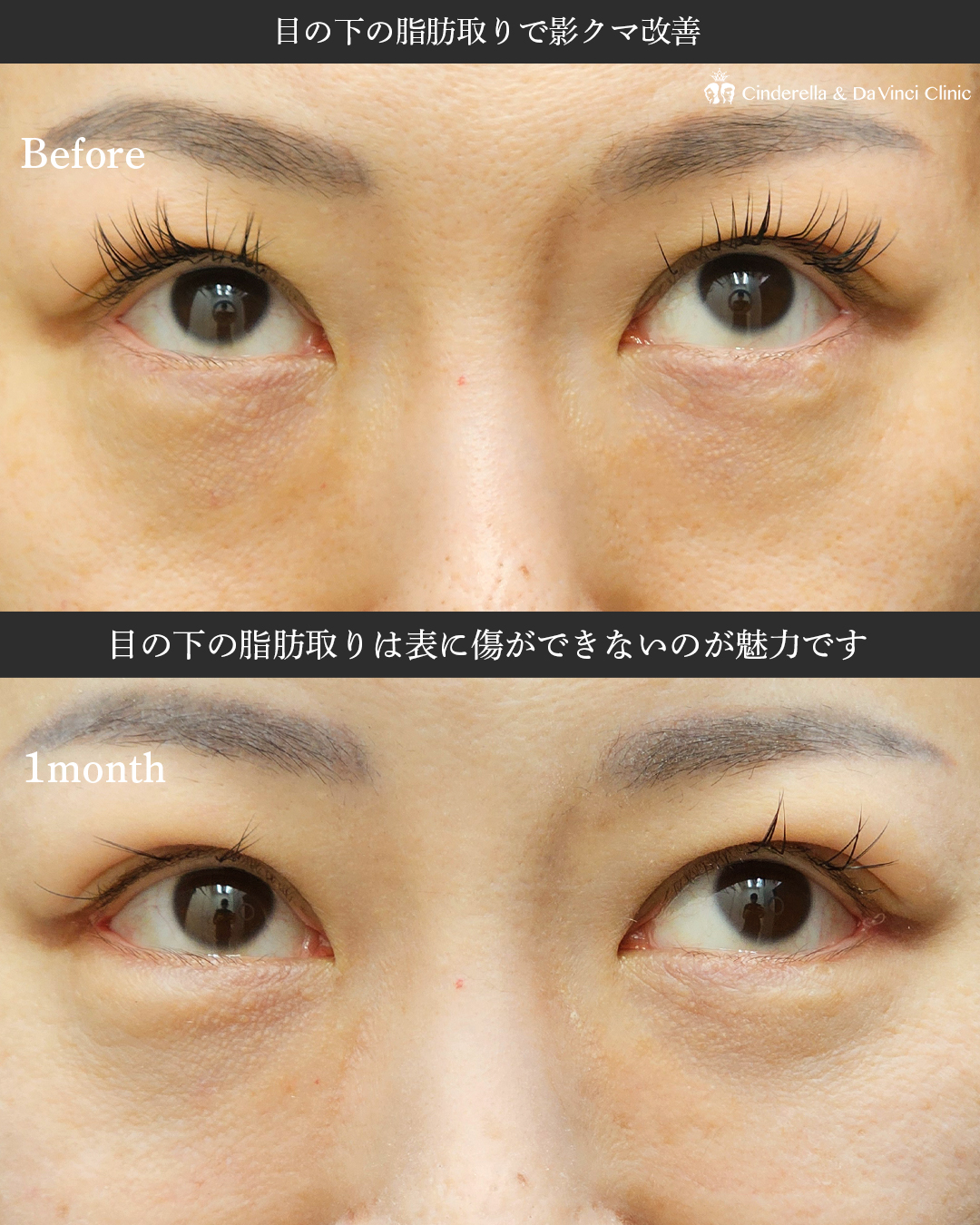 同時施術で変化の画像