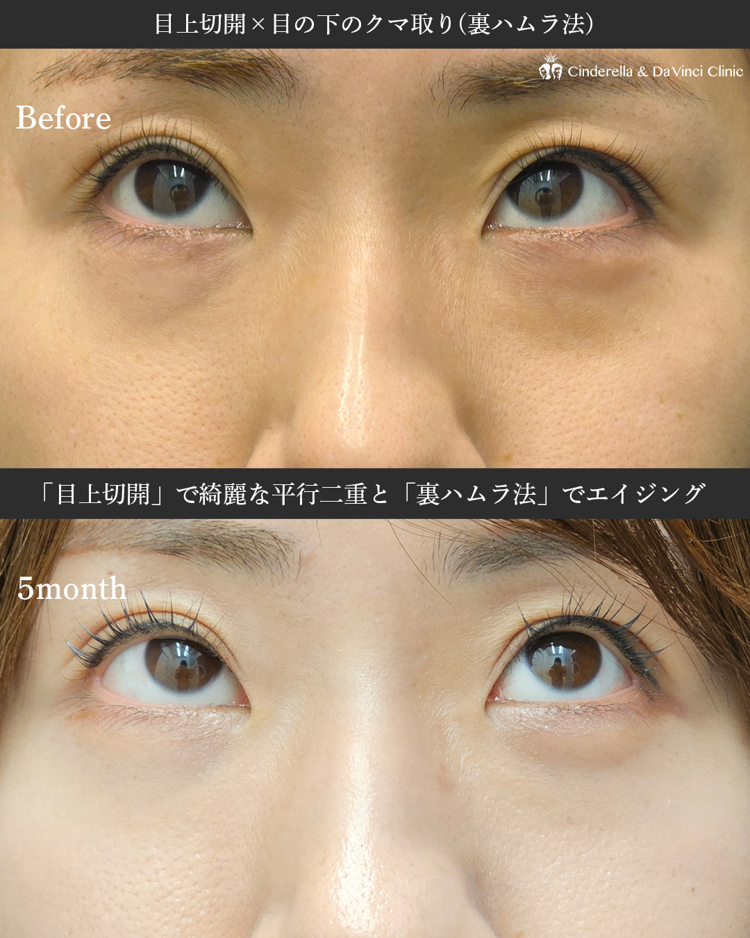 更に美しくなる施術の画像