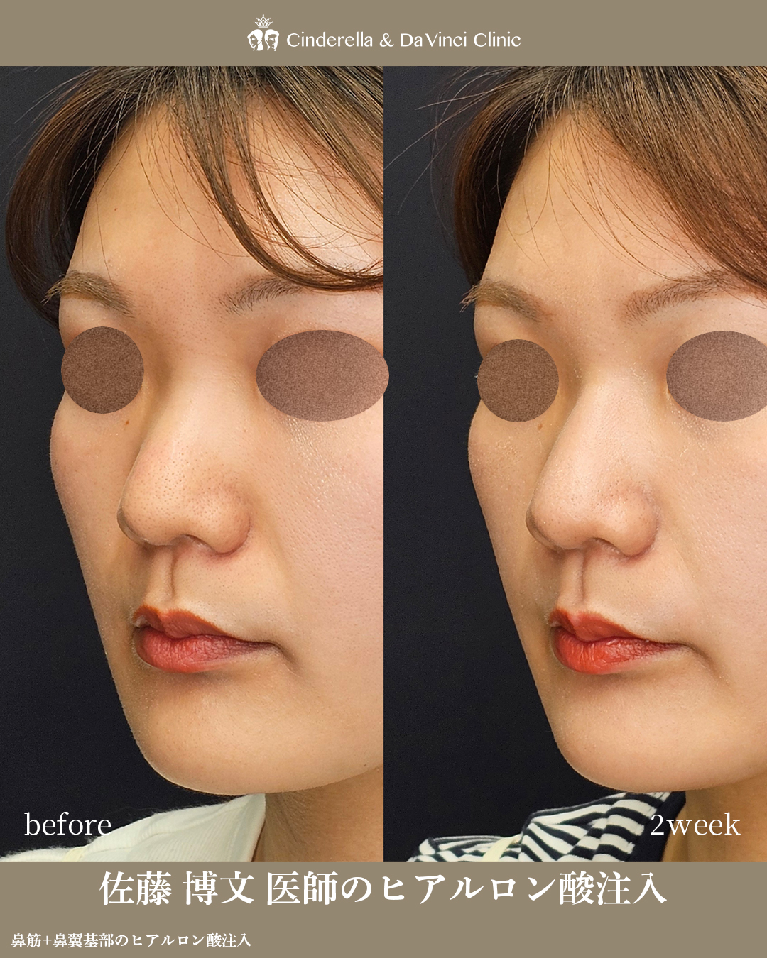 気品のある印象にの画像