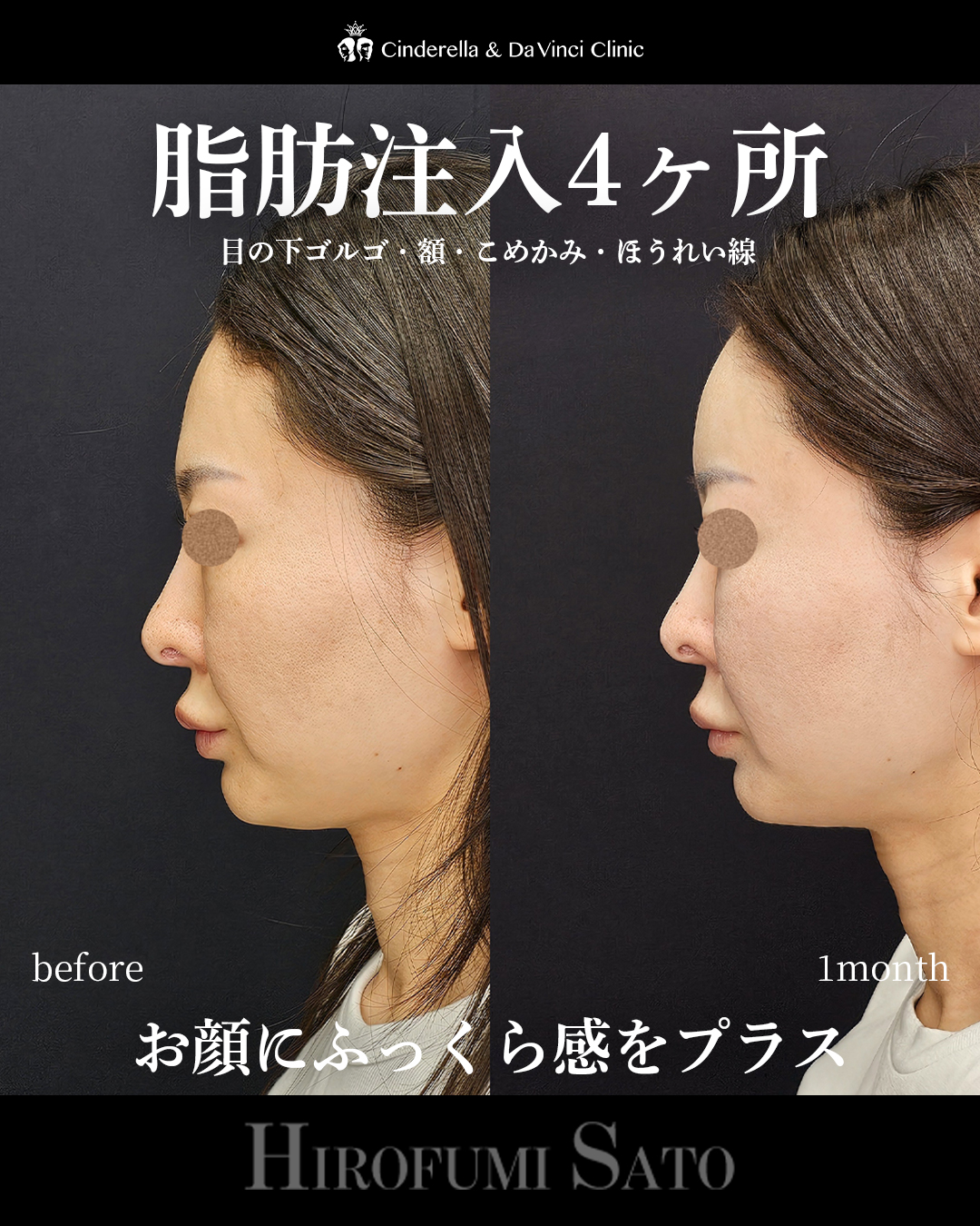 ふっくら感プラスの画像