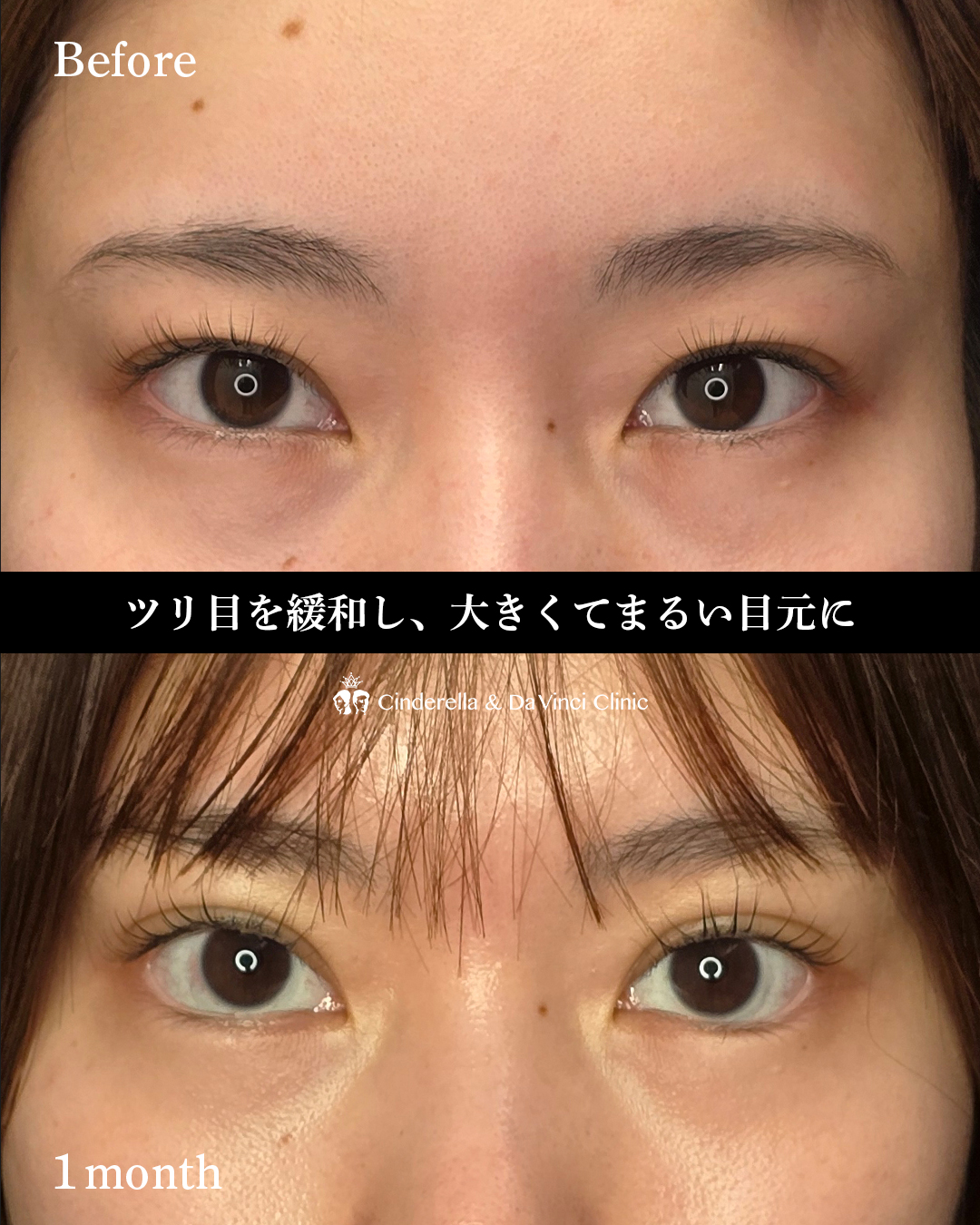 目を大きくするの画像