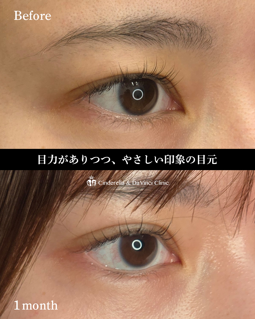 目を大きくするの画像