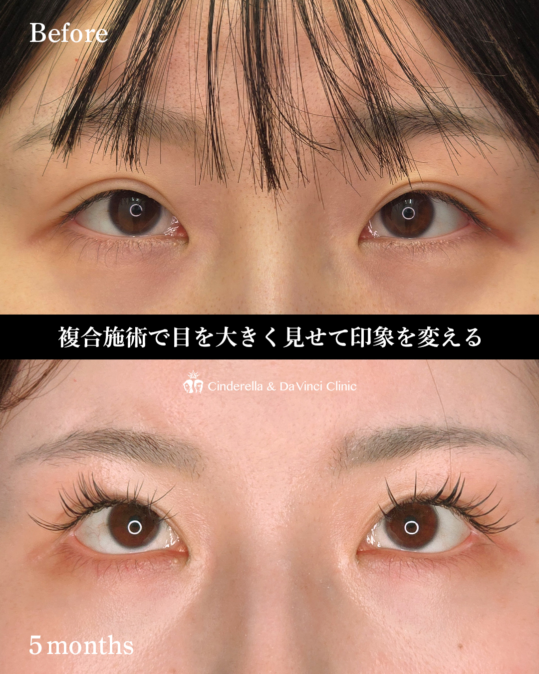 目の印象を変えるの画像