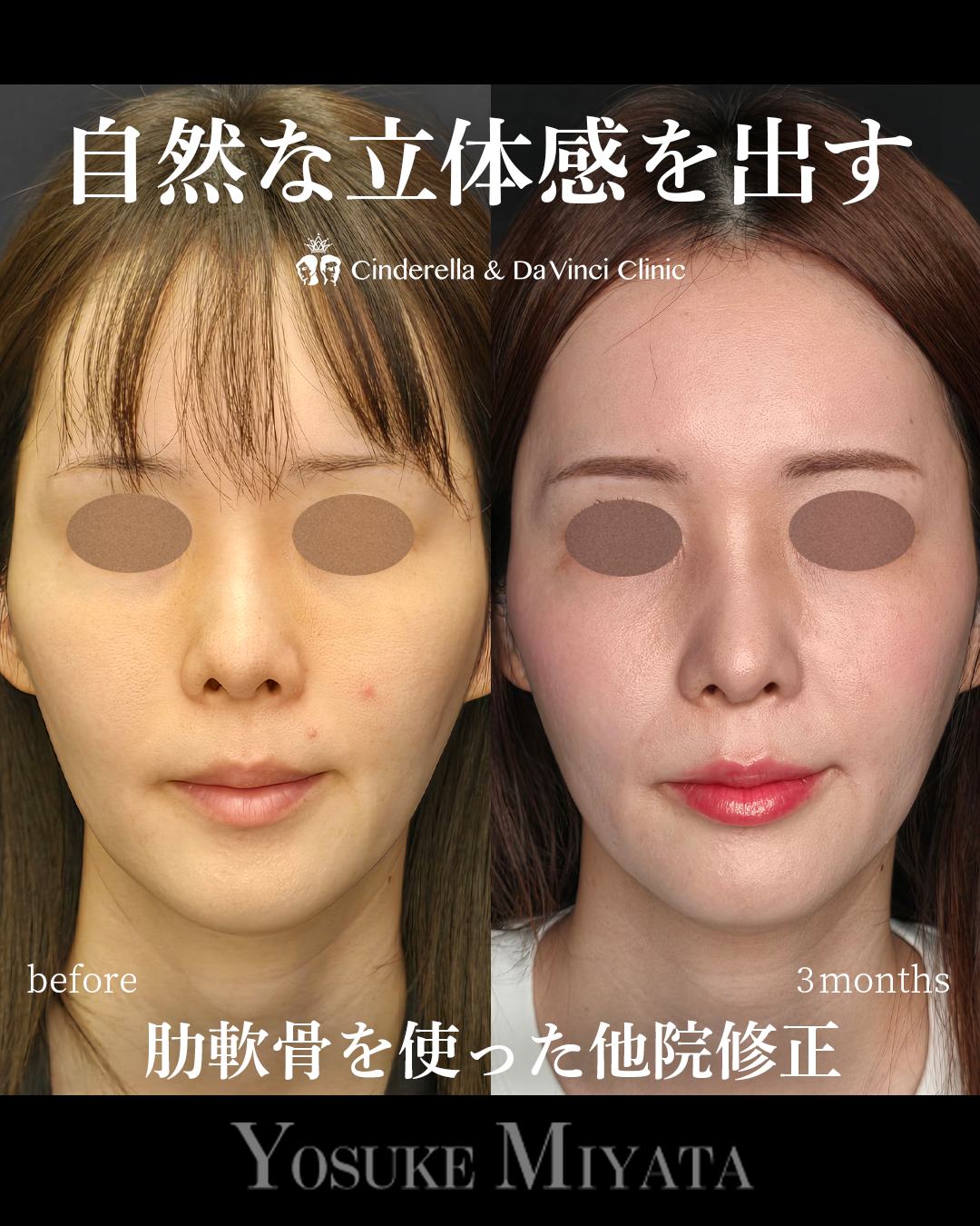 自然な立体感を出すの画像