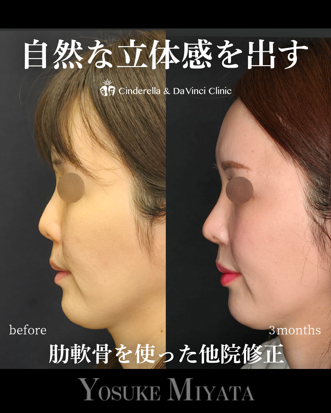 自然な立体感を出すの画像