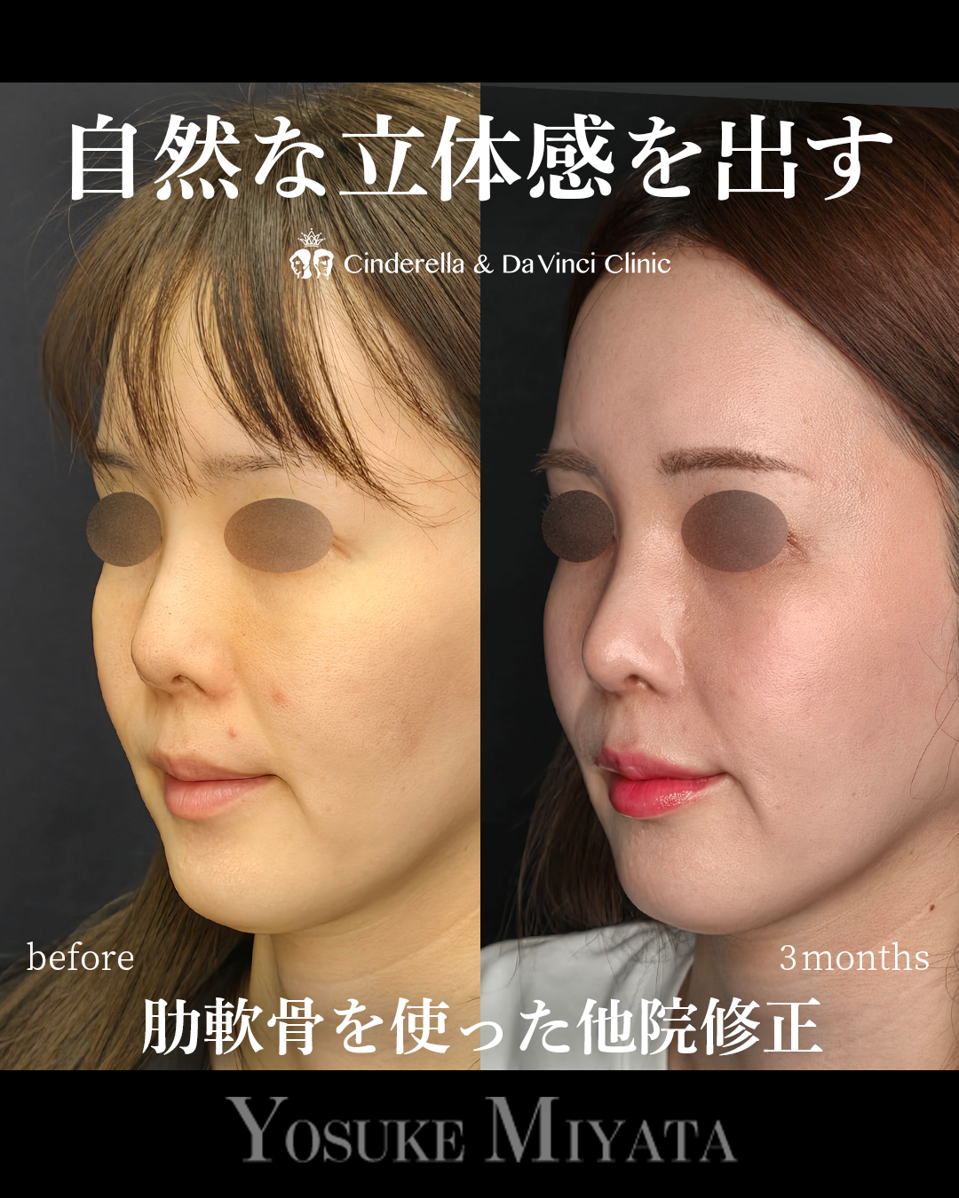 自然な立体感を出すの画像