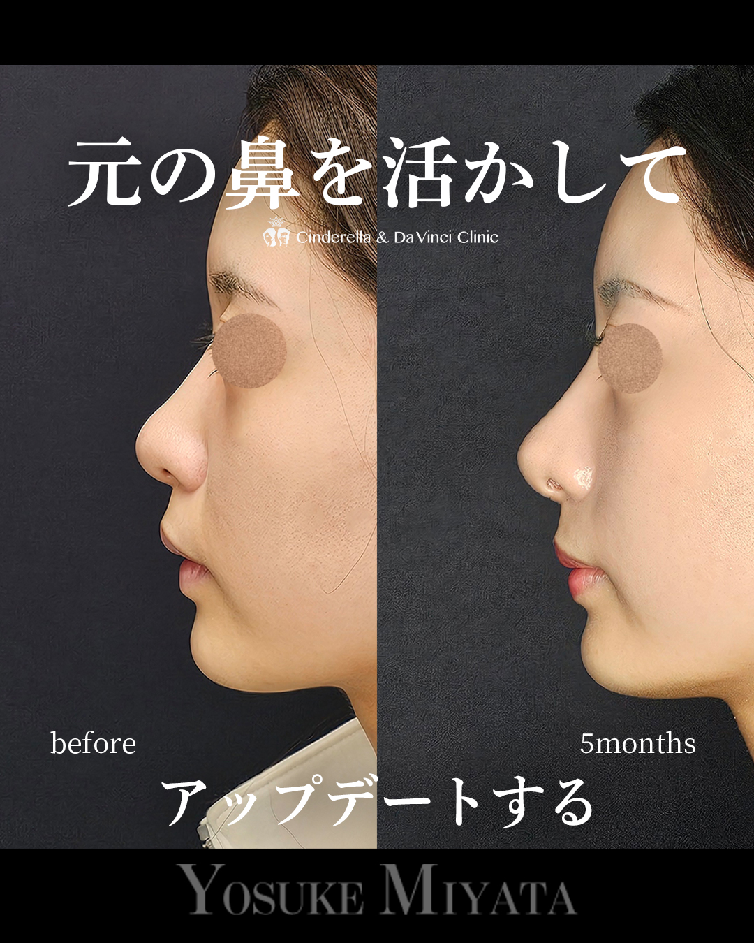 元を活かしてアプデの画像