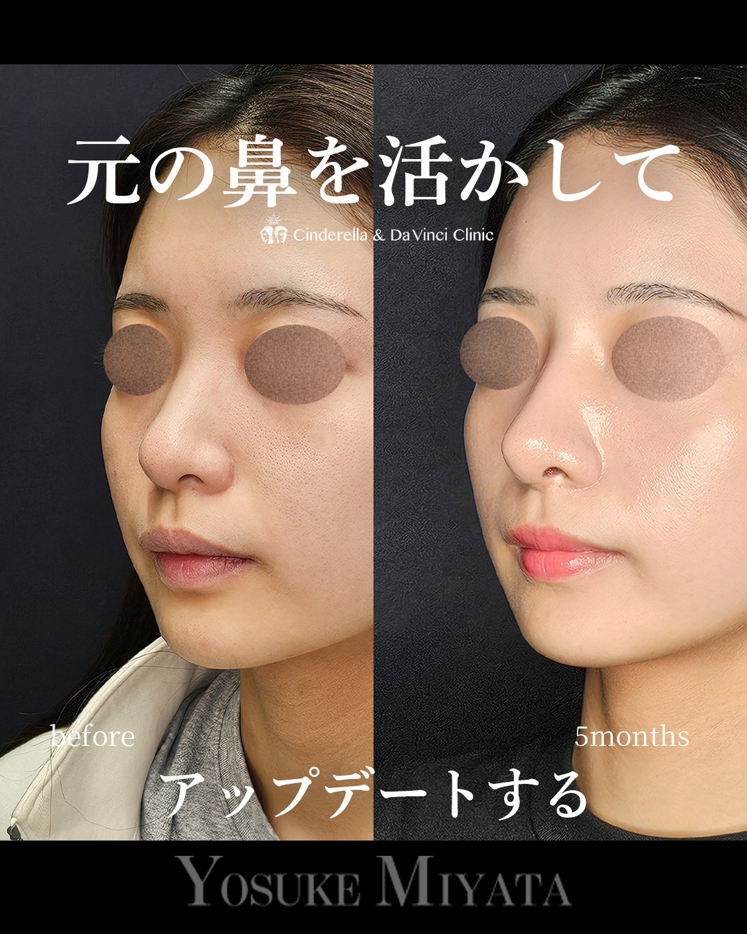 元を活かしてアプデの画像