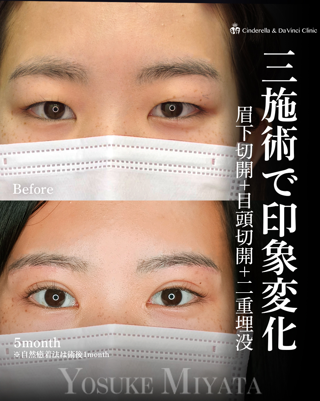 三施術で印象変化の画像